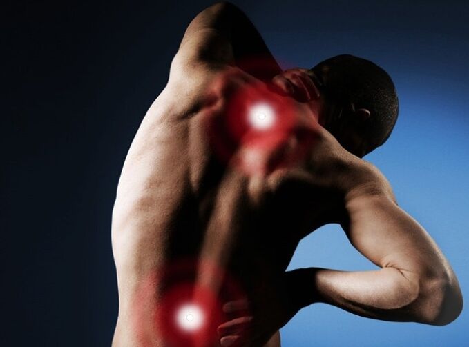 Dor de costas por osteocondrose espinal