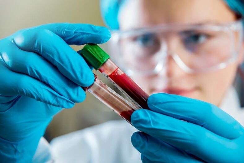Exame de sangue completo para diagnosticar dor nas costas